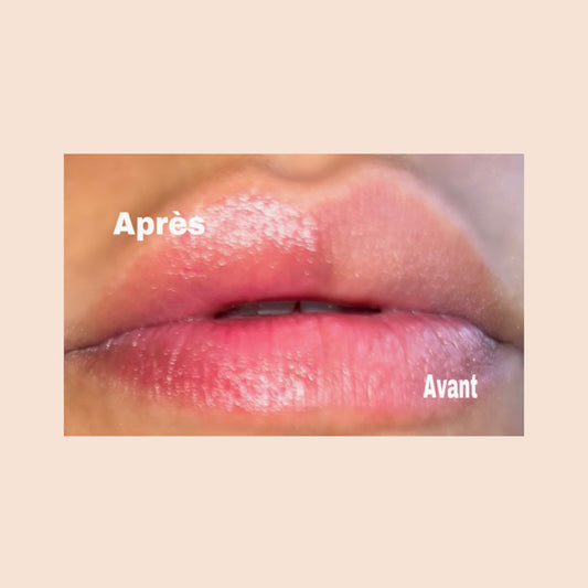 Baume à lèvres aloès